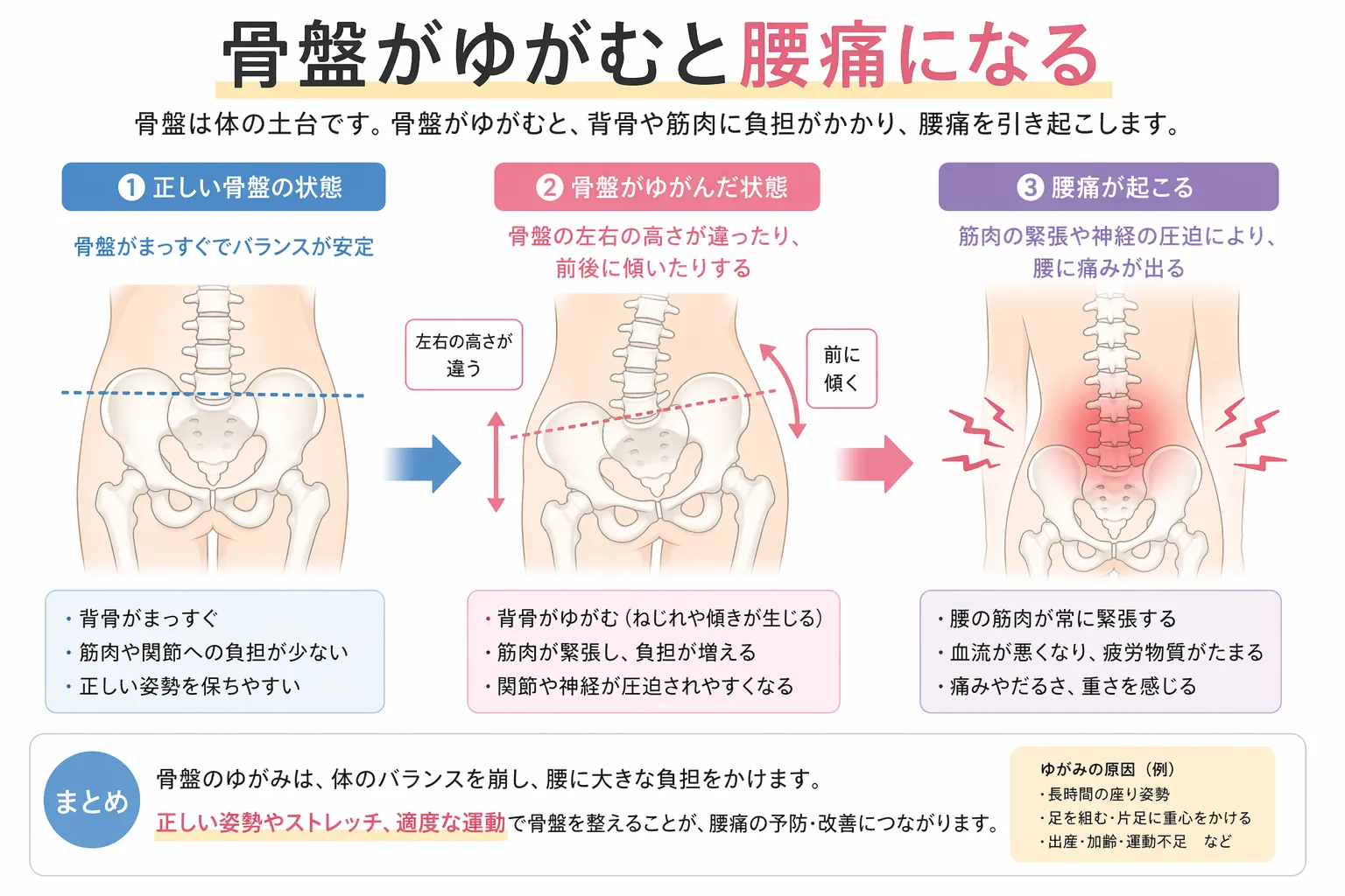 パーソナルジムで叶える骨盤のゆがみと腰痛の関係改善ストレッチと筋トで正しい姿勢を習得する方法